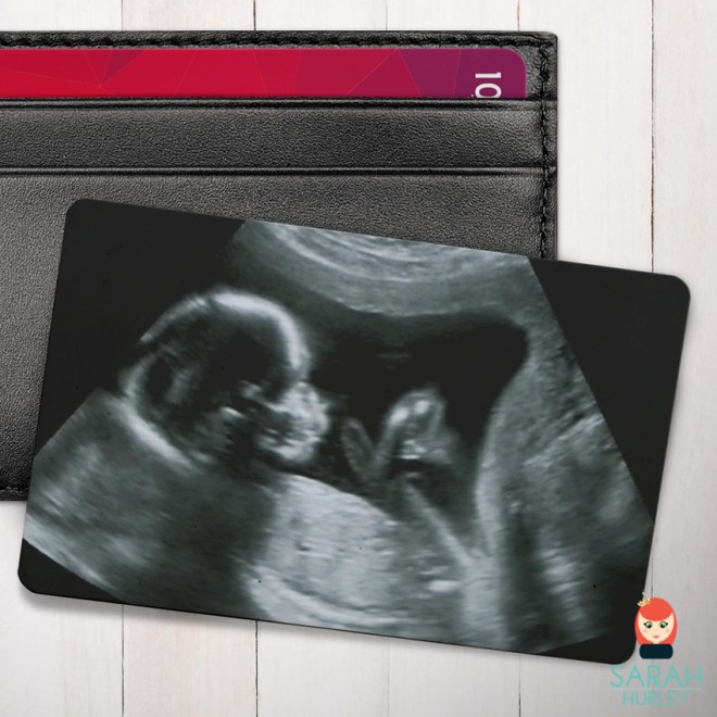 baby scan wallet card